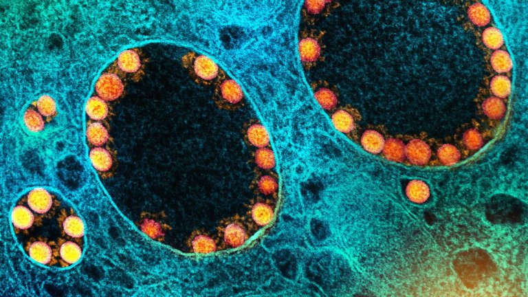 OMS declara fim da pandemia de covid-19