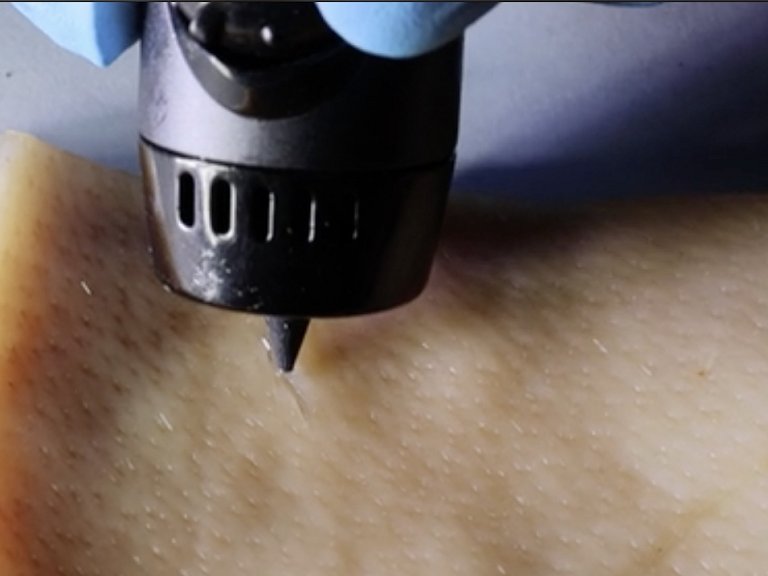 Curativo de pintar: Tinta cicatrizante cura feridas e evita inflamação