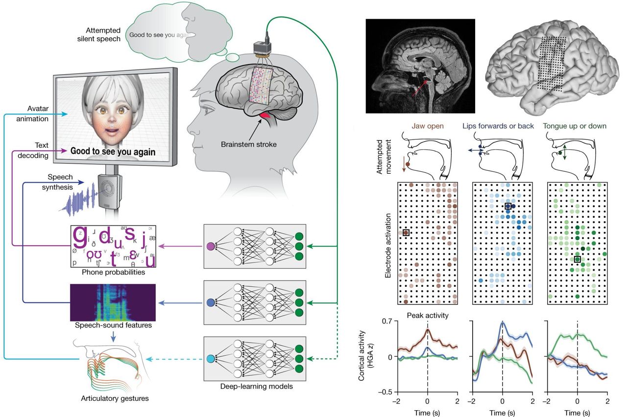 Interfaces crebro-computador traduzem sinais cerebrais em fala ou texto
