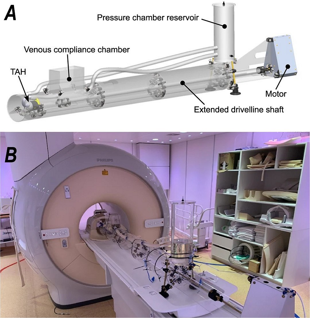 Exame mostra que corao artificial pulsante  seguro