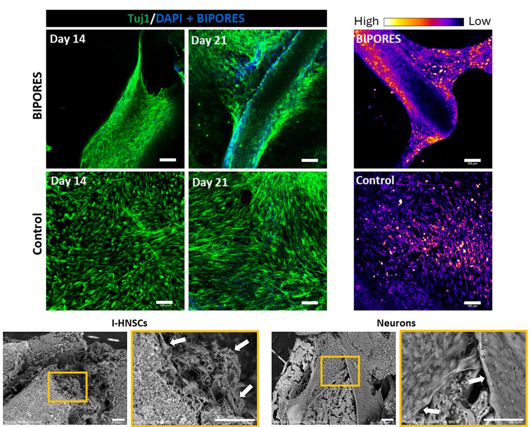 Cientistas criam primeiro modelo de tecido cerebral totalmente sint�tico
