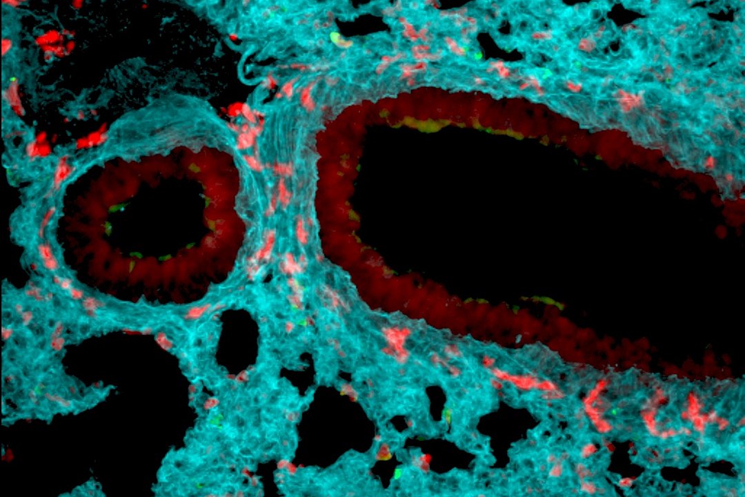 Neutr�filos: C�lulas imunol�gicas agem como um coletivo, e n�o individualmente