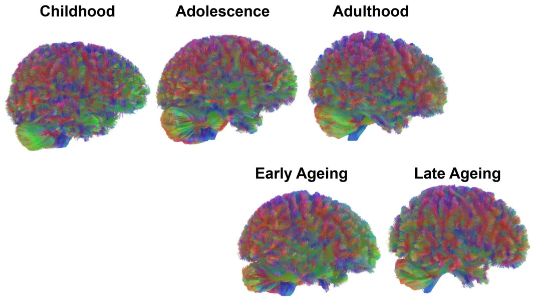 Crebro humano tem cinco fases claras de desenvolvimento