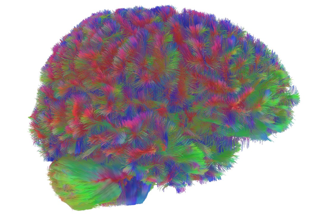 Crebro humano tem cinco fases claras de desenvolvimento