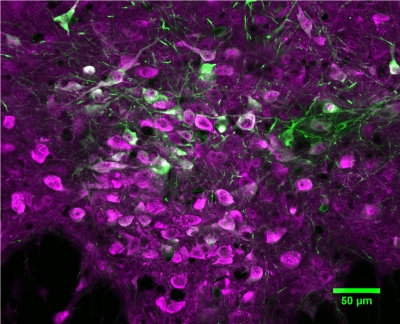 Serotonina acelera a aprendizagem