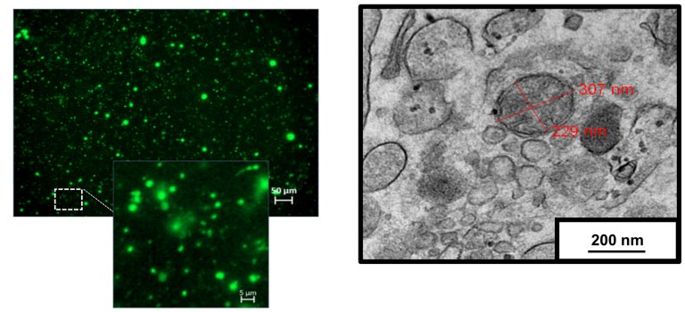 Mitocndrias extracelulares: Descoberto novo componente do sangue humano
