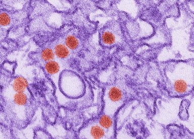 Medicamento experimental evita microcefalia causada pelo vírus zika