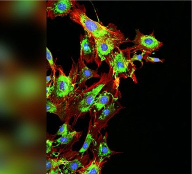 Cientistas aproximam-se de identificar a causa do cncer de uma pessoa