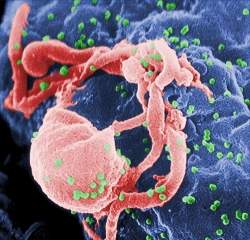 O HIV pode estar se tornando mais virulento