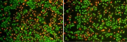 Componente do alecrim protege olhos da degenerao macular