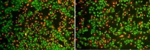 Componente do alecrim protege olhos da degenerao macular