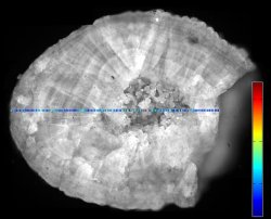 Pedras dos rins poderão ser analisadas na hora