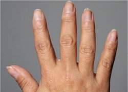 Exame das unhas permite fazer avaliao nutricional