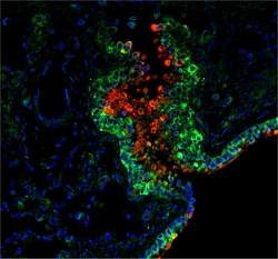 Intestinos parecem formar um 