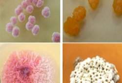 Bactérias de ambientes extremos são esperança de novos medicamentos