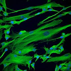 Células-tronco do cordão umbilical para medicina regenerativa