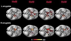 Estudo relaciona sexualidade e simetria dos hemisfrios cerebrais