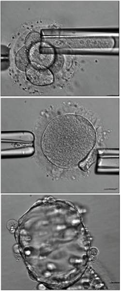 Clonagem humana gera células-tronco embrionárias