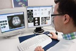 Novas técnicas ajudam no diagnóstico precoce da doença de Alzheimer