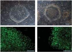 Cientistas descobrem como estudar doenas que atingem clulas-tronco