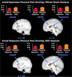 Dor da rejeio e dor fsica ativam mesma regio do crebro