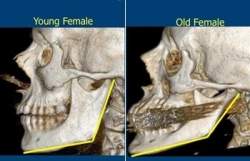 Envelhecimento facial é mais profundo do que uma pele flácida