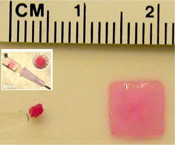 Esponja injetvel carrega medicamentos ou clulas-tronco