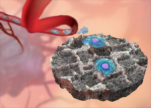 Esponja captura clulas de cncer antes que formem tumor