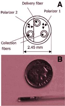 Sonda de luz detecta cncer de pncreas  distncia