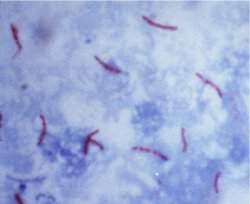 Farmanguinhos fabricará medicamentos para tuberculose