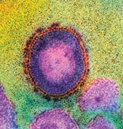 Sequenciado o genoma do HIV