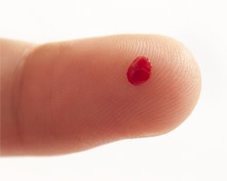 Resultados de exames de sangue variam de uma gota para outra