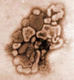 Efeitos da gripe espanhola ainda persistem