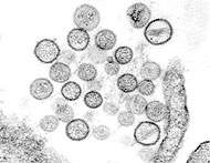 Hantavirose deve ser olhada com cuidado, enquanto é apenas uma zoonose