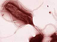 Infecção por bactéria varia segundo a classe social
