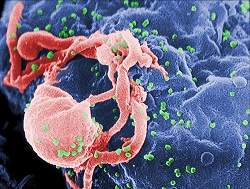 Vacina múltipla contra AIDS produz resultados modestos