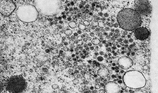 Divulgada primeira imagem do vírus zika