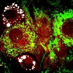 A obesidade está ligada à insulina, e não aos genes, descobrem cientistas