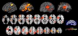 Cientistas descobrem onde a inteligência mora no cérebro