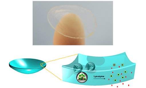 Lente de contato com nanodiamantes trata glaucoma automaticamente