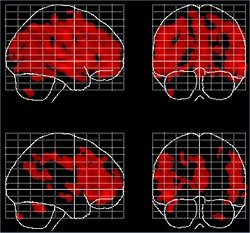 Meditao causa mudanas neurobiolgicas benficas