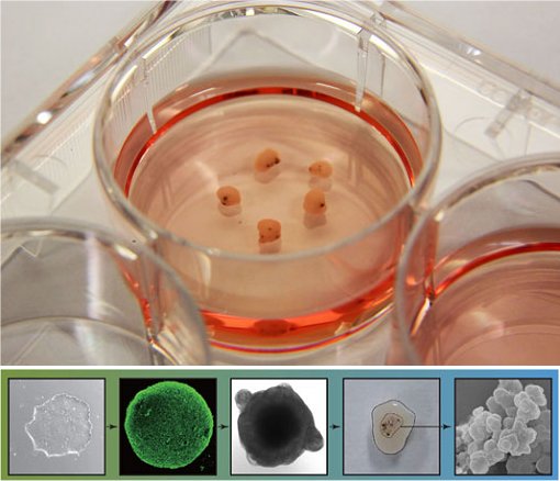 Cientistas cria minicrebros para estudar Parkinson