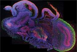 Cientistas criam minicérebros em laboratório