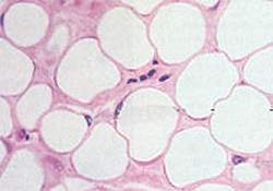 Descoberta molcula capaz de tratar o diabetes e a obesidade