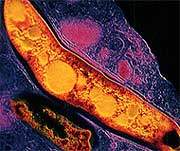 Teste molecular desenvolvido no Brasil detecta tuberculose de alta complexidade