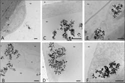 Nanopartculas de titnio rompem barreira de proteo do crebro