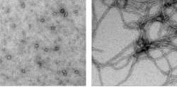 Alzheimer pode ser estgio final do diabetes tipo 2