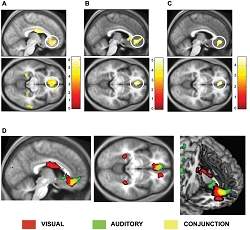 A beleza est no crtex rbito-frontal medial de quem v