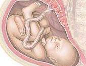 Citoscopia fetal opera bexiga do bebê durante a gravidez