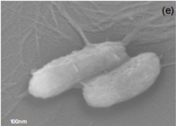 Nanopartículas destroem bactérias resistentes a antibióticos